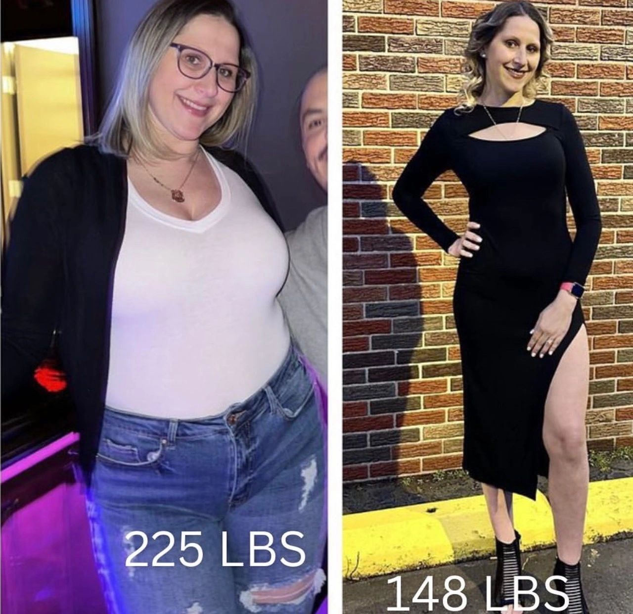 Weight loss success story 4 - All Health Medical Group patient transformation