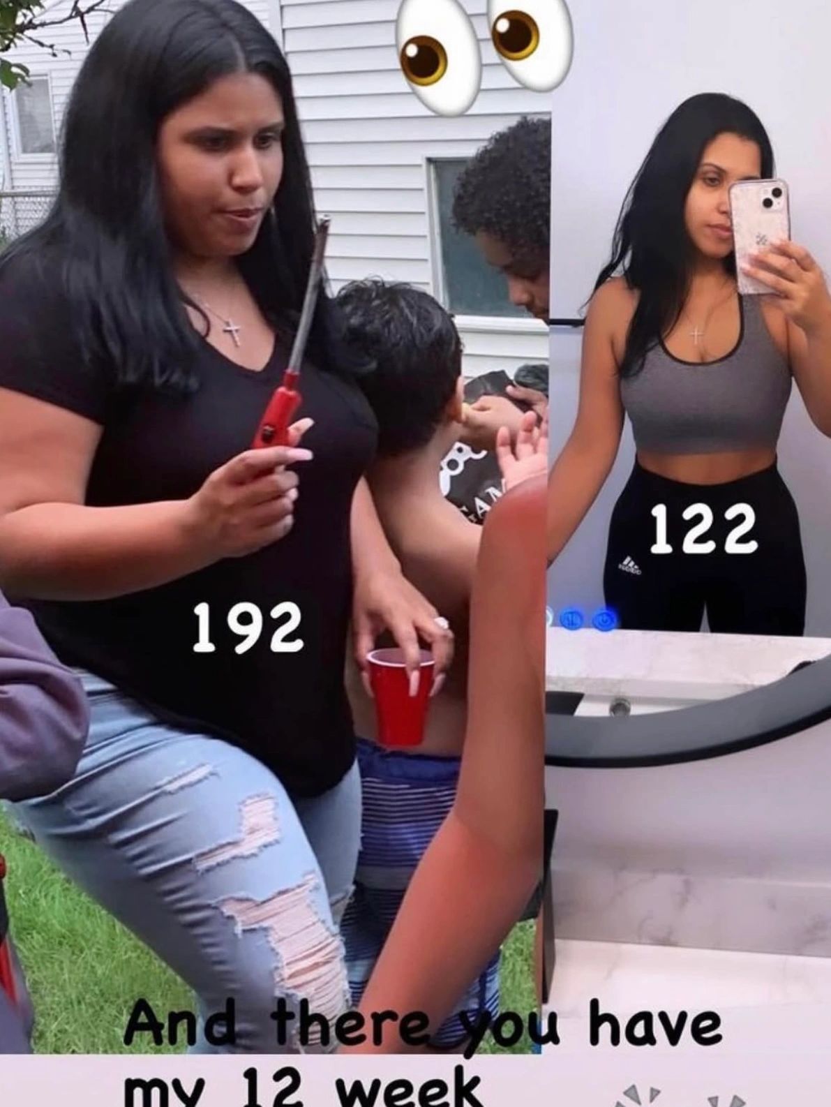 Weight loss success story 5 - All Health Medical Group patient transformation